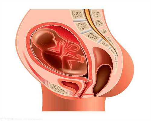 哪里做代孕:宫颈粘连的症状是什么