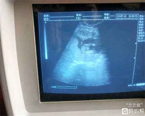 许昌供卵代孕：下腹有时疼,附件两侧右侧7-5,左侧