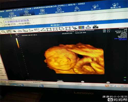 上海代怀孕有出生证吗_男人备孕能吃狗肉吗