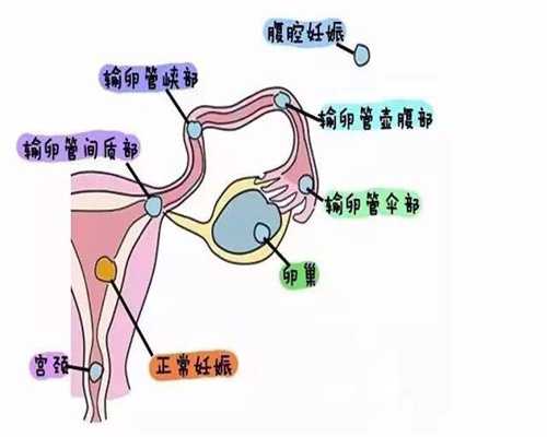 天津本地代孕公司_第三代试管可以选择性别吗